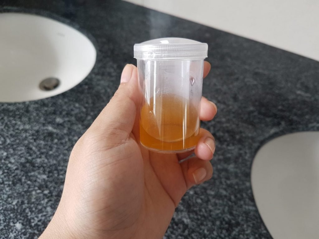 Urinprobe