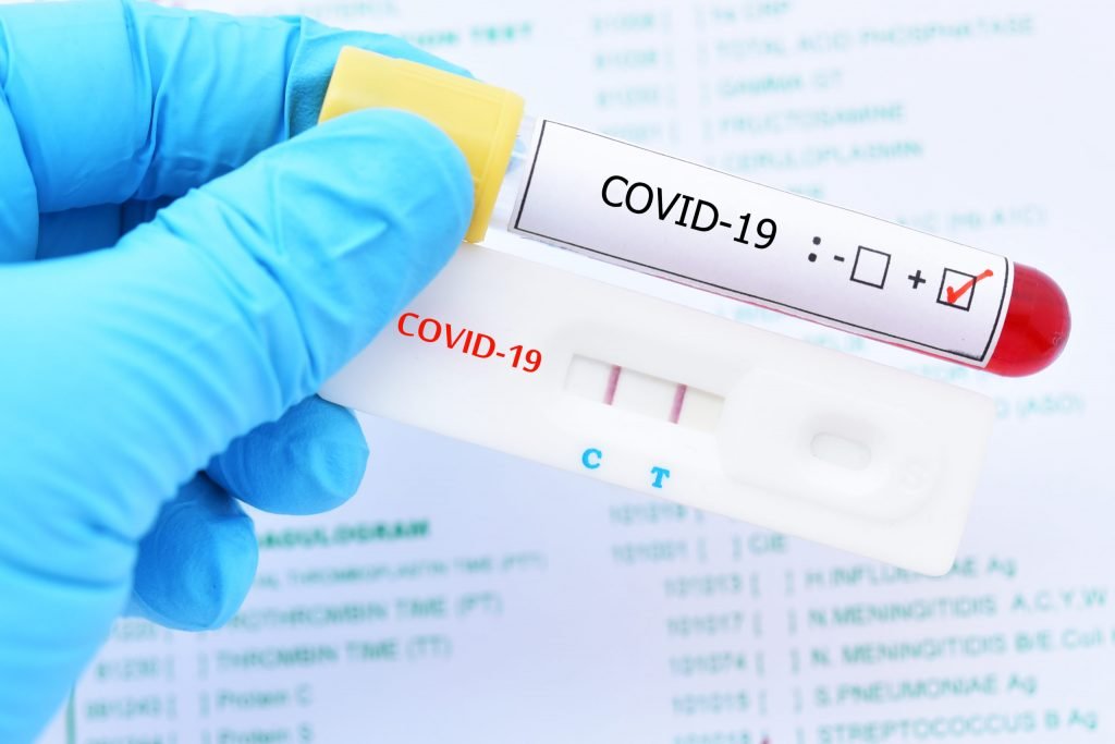 Positive test result